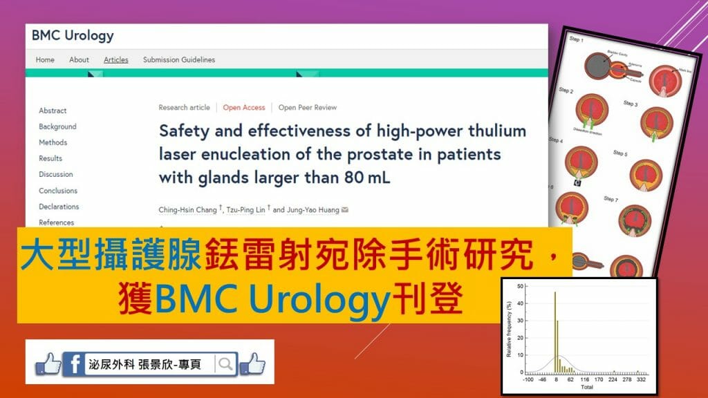 大型攝護腺銩雷射宛除手術研究，獲BMC Urology刊登 1